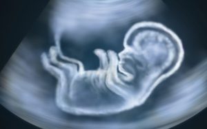 ultrazvuk u trudnoći