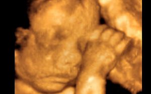 slika s ultrazvuka